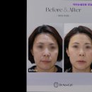 닥터뉴셀의원 | [강남 피부과 추천] 닥터뉴셀의원 강남본점 닥터뉴셀의원 강남본점, 최상의 피부 관리