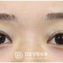 두땀