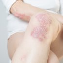 청담엔케이피부과청담NK피부과 이미지