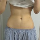 행복중심용산생협 | 제팻주 2회차 후기ㅣ 용산비만클리닉 제로팻 가격,후기