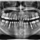 서울이오스치과교정과치과의원 이미지