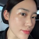 홍제한의원 | 홍제동 한의원 추천 편평사마귀 제거 솔직후기 홍제온한의원