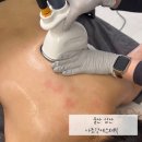 나조각에스테틱 | 울산 피부관리 나조각에스테틱 상체후면 에너지테라피 관리 후기