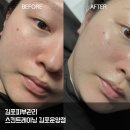 6589 | 김포슈퍼젝션 받고 피부 달라짐..! 스킨트레이닝센터 김포운양점 리얼후기