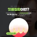 이기쁨치과의원 네이버블로그