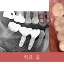 연세바른치과 이미지
