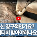 다나두피 이미지