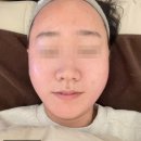 아이섭 이미지
