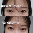 뷰네핏