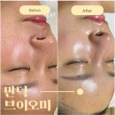 부산 만덕 피부관리, 브이오미 에스테틱 V쫀쫀케어 관리 찐후기 (구 미소뷰티)