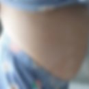김미란 | [시험관 1차 성공] 다낭성 난자채취 후 복수증상 후기(아주대학병원 김미란 교수님)