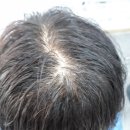 자르세헤어 이미지