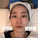 씨유 해운대 센텀점 | 💎 해운대 센텀피부관리 리프팅 토닝 후기 — 1:1 프라이빗케어로 만족도 최고✨