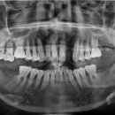 열린오치과의원 이미지