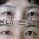 넬라스 이미지