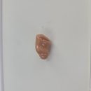 목동독일보청기 이미지