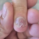 네일아트 | 압구정로데오 네일샵, 물어뜯는 손톱 연장 네일아트 후기