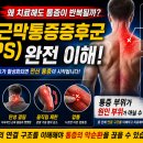 근막이 무너지면 왜 통증이 반복될까? 근막-골격 체계(Myofascial-Skeletal System)와 인체 구조의 비밀 이미지