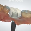 R - Dental 티스토리