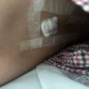 에덴병원 제왕절개 특실후기