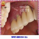 NYU서울치과의원 네이버블로그