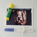 [당첨후기] 19주 4일차 임산부 영양제 복용 후기