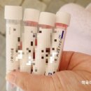 늘이비인후과의원 | 송도 늘이비인후과 방문기