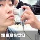 송파대로28길 | 얼굴 트러블흉터 관리, 라라필톡스로 모공 자국 개선 후기