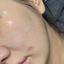 썸띵뉴 | ✨ 마이온유니크네스 썸띵 뉴 워시오프팩 후기 ✨