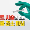 스텐트 시술의 진짜 효과 이미지
