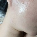 피부관리샵 라보떼에스테틱 오산점 후기