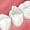 이바른치과의원 이미지