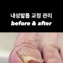 닥터아이티엔챈네일