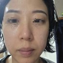 플래닝짐 | 파주스킨플래닝 솔립뷰티, 매끄러운 깐달걀 피부 만드는 스킨플래닝추천 솔직후기