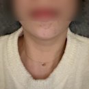 오토케어샵 | 김포 피부관리 | 구래동 여드름피부관리 솔에스테틱 피부케어샵 솔직후기