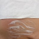 7015 | 강남등드름 온담에스테틱 가드름 색소침착 관리 후기