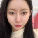 순자 | 부산 서면피부과 올타이트리프팅 순자리프팅 내돈내산 후기