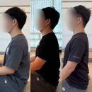 고개를 뒤로 넘길 때 목통증 있다면 꼭 보세요.(일자/거북목 교정운동)