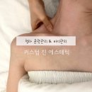 청라경락 커스텀 진 에스테틱 볼패임 비대칭 윤곽관리 좋은 청라에스테틱