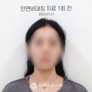 모드니한의원 | 청담턱관절한의원 모드니한의원 1회 치료 솔직후기