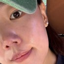 온리빛의원 내돈내산 쥬베룩 스킨 후기