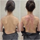 토탈플랜 | 대구 신부관리 원플랜 대구 피부&에스테틱에서 웨딩 전 토탈케어 받은 솔직후기