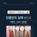 영양치과의원 | 임플란트가 흔들려요. 임플란트 실패 원인과 예방 관리법 / 강남레옹치과