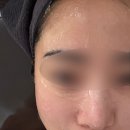 온리유스킨케어 - 당진시 | 청주 피부관리 전문 온리유스킨앤바디 트러블피부 물광필후기
