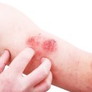 발란체한의원 이미지