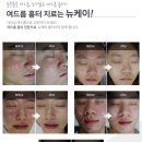 강남더케이의원 이미지
