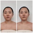 삼영오피스텔 | 잠실 얼굴윤곽 관리 와 승모근 관리 고민이라면 위뷰티잠실점으로 !