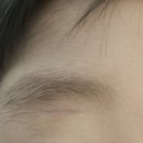 제나성형외과의원 | 아이가 다쳐서 한땀성형외과에 다녀왔습니다!