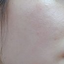 안아픈 리들샷 포텐자 셀린토 피코 타이트닝 엑소좀 앰플 사용후기