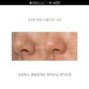 엔에이지